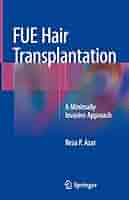 FUE Hair Transplantation: A Minimally Invasive Approach