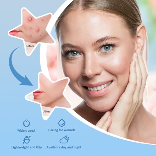 Save 38% on Star Acne Patches - 200 hydrocolloid stickers - Image 4
