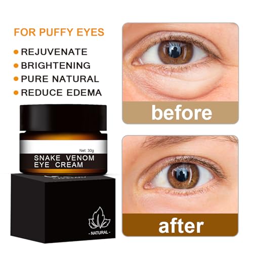 Snake Venom Eye Cream - Anti Wrinkle Eye Cream For Puffiness + Wrinkles, Brightening Under Eye Cream, Diminishing Deep Wrinkles Dark Circle Eye Cream, Eye Bag Treatment For Men And Women, 30g - Image 6