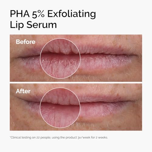 Image of The Ordinary PHA 5% Exfoliating Lip Serum