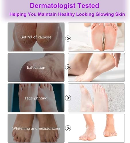 3 pares de máscaras para pies, calcetines para pies, calcetines para callosidades, mascarilla exfoliante para pies, cuidado natural y suave, mascarilla hidratante para pies para hombres y mujeres - imagen 6