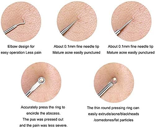 Image of 4Pcs Blackhead Pimple Remover Tools for Professional Tweezers Kit for Remove Acne Comedone Extractor, Black Heads Removing on Face Removal
