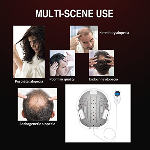 Hair Regrowth Devices,Hair Regrowth System To Grow Hair, Hair Treatment For Thinning Hair,Hair Growth Guide To Stimulate #TOP4