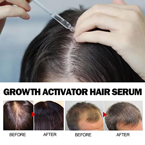 Essência de crescimento capilar – Ativador de cabelo orgânico nutritivo – Suplemento de crescimento