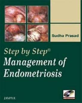 STEP BY STEP MANAGEMENT OF ENDOMETRIOSIS WITH DVD-ROM