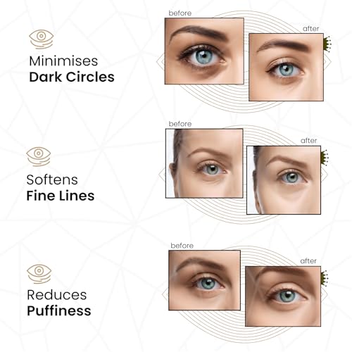 Miniatura 3 de Revitale Mascarilla De Colágeno Para Las Bolsas De Los Ojos De Oro, Mascarilla De Cuidado De La Piel Hidratante Anti Arrugas, Ácido Hialurónico Paquete De 30