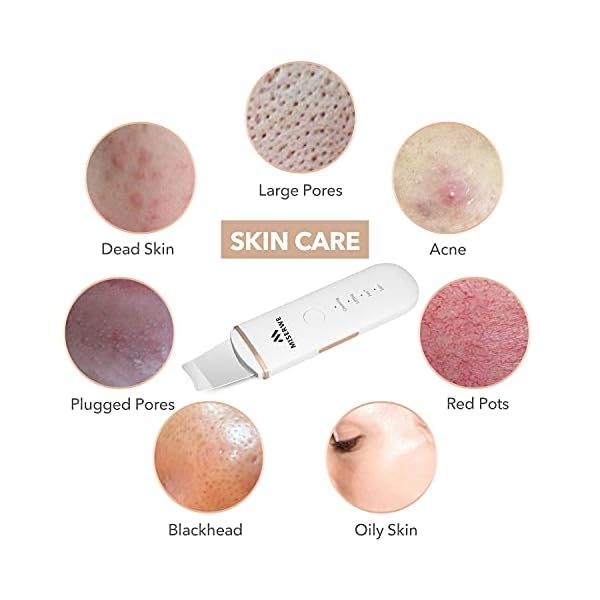 Skin Scrubber Face Skin Spatula Ultraschallpeelinggerät Skin Scrubber Mitesserentferner Porenreiniger Gesicht… – Bild 5