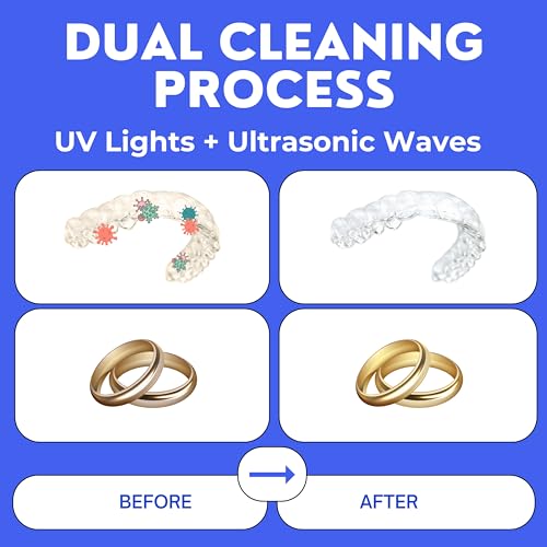 Image of Ultrasonic Retainer Cleaner, UV Cleaner for Invisalign, Night Guard, Mouth Guard, Jewelry - Retainer Cleaning Machine