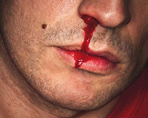 Nasalcease Firstaid Nosebleeds, 5-Count Box #TOP3