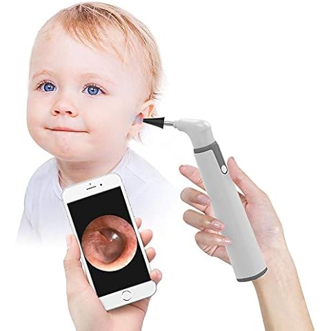 Wireless Otoscope, Ear Scope with 720P HD Ear Camera and 6 LED Lights, Ear Wax Removal Tool Camera with Gyroscope, Digital Otoscope with Light, Compatible with iPhone and Android Cover