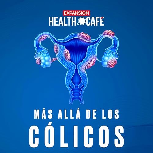 Endometriosis: el dolor invisible