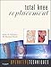 Operative Techniques: Total Knee Replacement: Book, Website and DVD