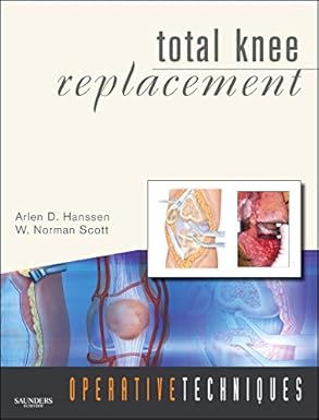 Operative Techniques: Total Knee Replacement: Book, Website and DVD