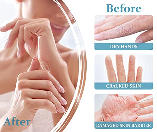 Verona Products Professional Hand Cream For Dry Cracked Hands - Moisturizing Hand Lotion Travel Size With Collagen & Hyaluronic Acid - Healing Hand Cream For Women #TOP2