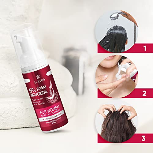 Women's 5% Minoxidil Foam For Hair Thinning And Hair Loss, Hair Growth Treatment For Women's Thicker And Fuller Hair, 2 Pack Of 60G #TOP4