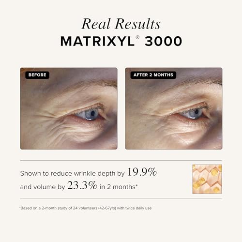 Asterwood Matrixyl 3000 + Argireline Serum for Face - Multi Peptide Serum with Hyaluronic Acid - Anti-Aging, Wrinkle Reducing, Collagen Boosting - Fragrance-Free - 1 Fl Oz - Image 5