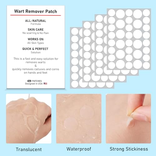 Image of WABRINY Wart Remover Patches, Fast & Easy Operate Hydrocolloid Gel Waterproof Invisible Sticker -CM