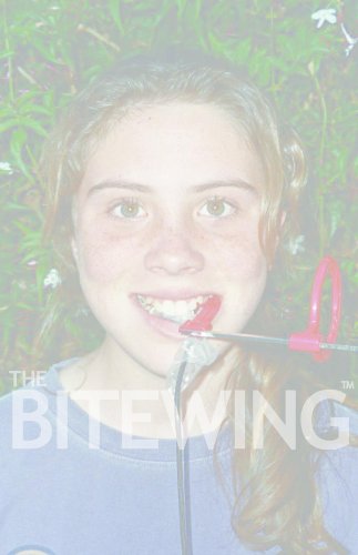 A DEMONSTRATION OF DIGITAL RADIOGRAPHY Technique for the Bitewing ...
