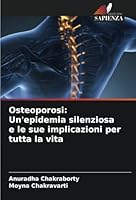 Osteoporosi: Un'epidemia silenziosa e le sue implicazioni per tutta la vita (Italian Edition) 620881314X Book Cover