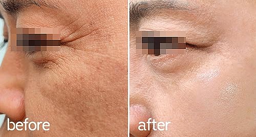 Whitesilk Anti-Aging Eye & Neck Scm(Human Stem Cell) Power Ampoule (10Ml X 2Vials, 0.68Oz) #TOP4