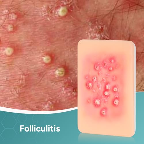 Image of Bacterial Infected Wound Model for Medical Education | Wound Packing Trainer, Palm Sized Wound Simulation Models, Wound Care Demonstrations Tool, 4PCS