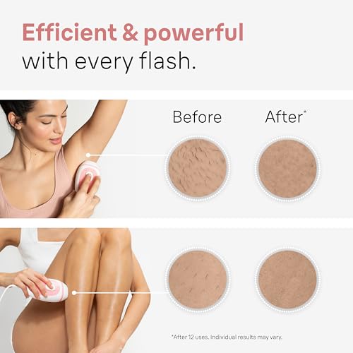 Braun-IPL-Long-Lasting-Hair-Removal-for-Women-and-Men-Silk-Expert-Mini-PL1014-with-Venus-Razor-Long-Lasting-Hair-Reducation-in-Hair-Regrowth-for-Body-Face-Corded