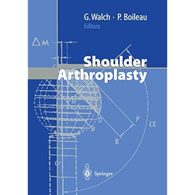 Shoulder Arthroplasty