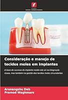 Consideração e manejo de tecidos moles em implantes (Portuguese Edition) 620847003X Book Cover