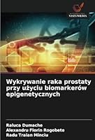 Wykrywanie raka prostaty przy uzyciu biomarkerów epigenetycznych (Polish Edition) 6208725593 Book Cover