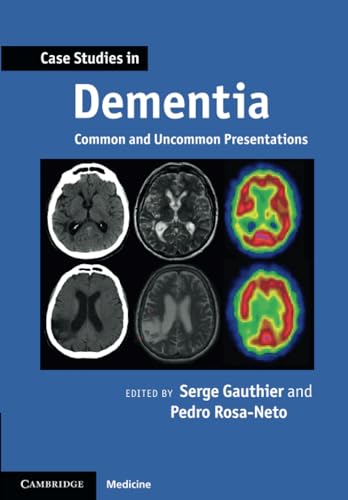 Case Studies in Dementia: Common And Uncommon Presentations (Case Studies in Neurology)