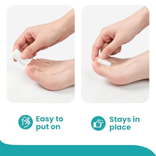 Image of Promifun Silicone Toe Protectors - 12 Pack Silicone Toe Sleeve for Hammer Toes, Corns, Calluses, Blisters - Soft Gel Toe Tube Pads for Pain Relief(Multi Sizes, White)