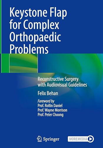 Keystone Flap for Complex Orthopaedic Problems: Reconstructive Surgery with Audiovisual Guidelines