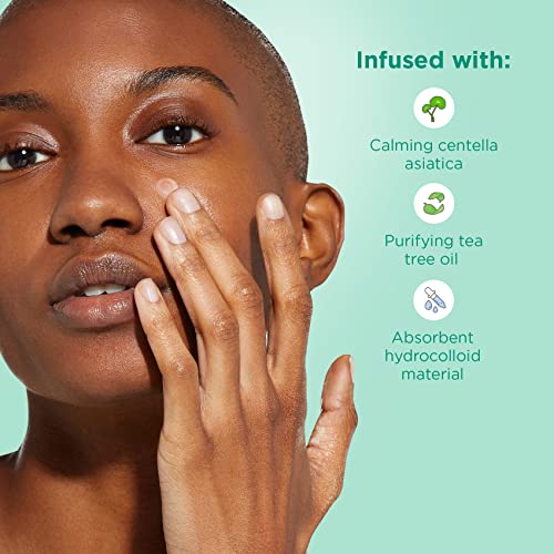Joah Heal Me Cica Spot Patch, Hydrocolloid Korean Skin Care Spot Patches With Centella Asiatica, 30 Patches, White #TOP2