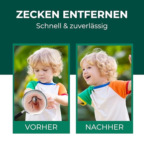 Silberkraft Zeckenzange Edelstahl - 2 in 1 Zeckenpinzette & Haken - Zeckenentferner für Mensch, Hund & Katze - Alternative zur Zeckenkarte - robust, rostfrei & wiederverwendbar