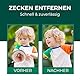 Silberkraft Zeckenzange Edelstahl - 2 in 1 Zeckenpinzette & Haken - Zeckenentferner für Mensch, Hund & Katze - Alternative zur Zeckenkarte - robust, rostfrei & wiederverwendbar
