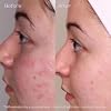 Yon-Ka Creme PG | Mattifying Protective Cream for Oily Skin | Anti-Aging Balancing Treatment for Shine and Redness | Paraben-Free | 1.68 oz
