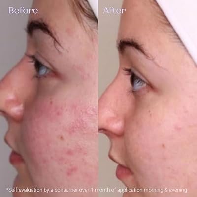 Yon-Ka Creme PG | Mattifying Protective Cream for Oily Skin | Anti-Aging Balancing Treatment for Shine and Redness | Paraben-Free | 1.68 oz