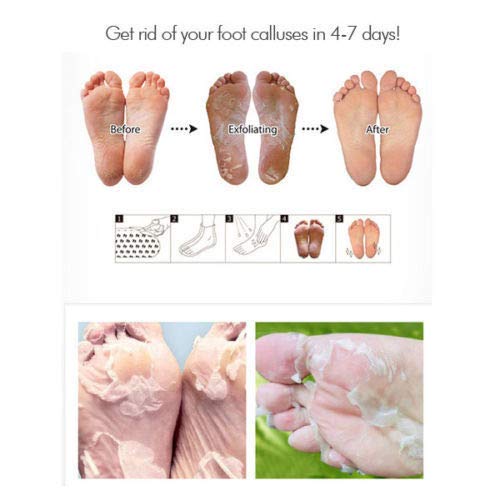 Exfoliating Large Foot Mask Papaya & Chamomile Extract - 1 Pair "Sock Type" Foot Exfoliating Large Mask Perfectly Peel Away Calluses And Dead Skin Cells In Just 2 Weeks!!! #TOP2