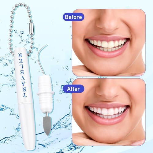 Image of 2PCS Premium Metal Toothpick Kit,Professional Teeth Cleaning Tools with Tartar&Plaque Remover,Portable Dental Picks Travel Tools,Reusable Oral Hygiene Tools with Keychain