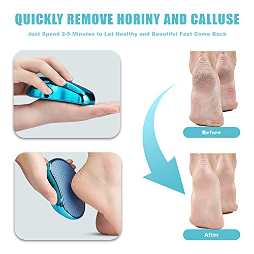 Puikos Foot File Callus Remover, Nano Glass Foot Skin Remover, Fast & Safe Foot Care Foot Callus Remover File, Waterproof & Portable Foot File Rasp For Home Pedicure Foot Spa (Blue) #TOP3
