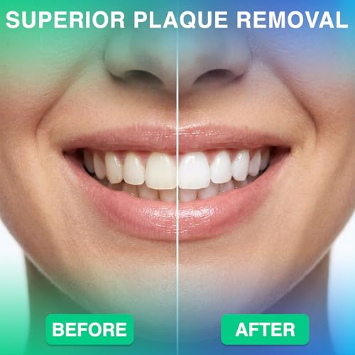 Image of Professional Water Flosser - Advanced Dental Care for a Healthier Mouth, Gum, and Teeth - IPX7 Waterproof Oral Irrigator | 7 Replacement Tips, Travel-Friendly, Rechargeable - Oral Hygiene (Grey)