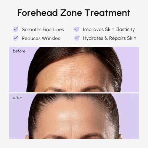 MAREE Forehead Wrinkle Patches 2 PACK – Collagen Wrinkle Patches with Retinol & Hyaluronic Acid for Face Lift – Fine Lines Deep Forehead Wrinkles Treatment Remover