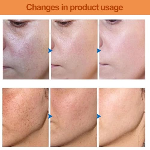 Solución Peeling AHA 30% + BHA 2%,Solución Exfoliante,Combate las Imperfecciones Reduce la Congestión de los Poros y las Líneas Finas,2 Pcs - imagen 5