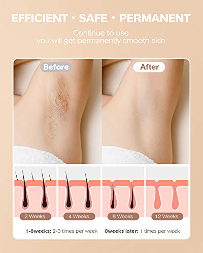 IPL Hair Removal for Women at-Home,Upgraded to 999,000 Flashes Permanent Painless Hair Remover,Facial Hair Removal Device for Armpits Legs Arms Bikini Line - Thumbnail 4