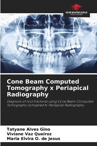 Cone Beam Computed Tomography x Periapical Radiography: Diagnosis of ...