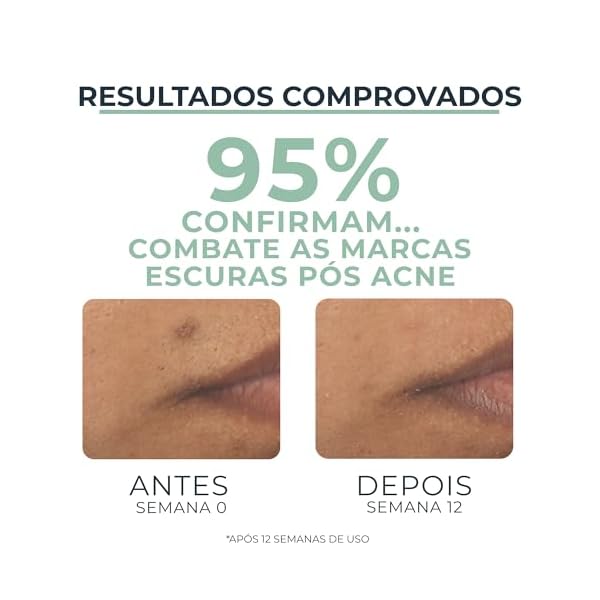 SÃ©rum Facial Eucerin Dermo Pure Oil Control Efeito Triplo 40ml - Imagem 6