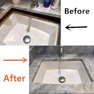 Complete Sink Repair Kit System-Undermount Sink Installation Kit- Bracket for kitchen (Patent)