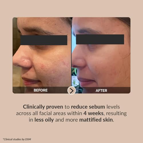 Image of LuxaDerme Pore Perfecting Korean Face Serum with Lotus Water, Galactomyces & Bifida Ferment | Clinically Proven Patented Actives to Minimize Pores, Control Oil & Sebum, Reduce Acne & Anti-Aging | Vegan Korean Skincare for Men & Women | 30ml