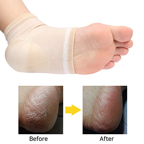 Spa Socks - Gel Heel Sleeves For Dry Cracked Feet – Silicone Moisturizing Socks (Nude, 1 Pair) #TOP5