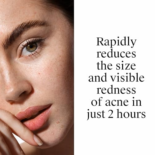 Neutrogena Rapid Clear Stubborn Acne Spot Treatment Gel, 1 oz - image 6